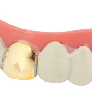 Dentier rigide avec p‚te - dent or