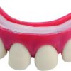 Dentier rigide avec p‚te - dents ÈcartÈes