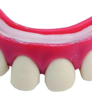 Dentier rigide avec p‚te - dents ÈcartÈes