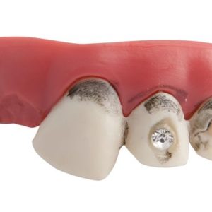 Dentier rigide avec p‚te - dents sales avec faux diamant