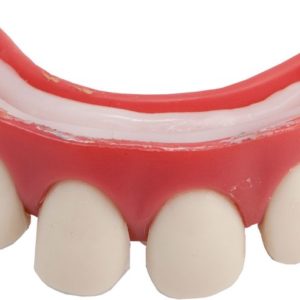 Dentier rigide avec p‚te - dents ÈcartÈes