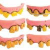 Dentier souple - modËles assortis